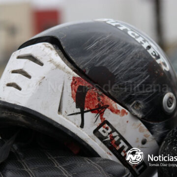 2 Motociclista sufre graves lesiones tras caer en zanja de la Vía Rápida Oriente