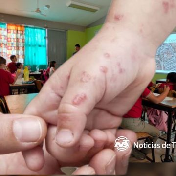 Alerta sanitaria en Baja California: Suspenden clases presenciales por aumento de casos de Coxsackie