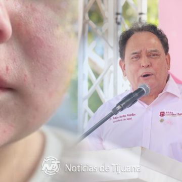 Refuerzan vigilancia sanitaria para evitar brote de sarampión en Baja California