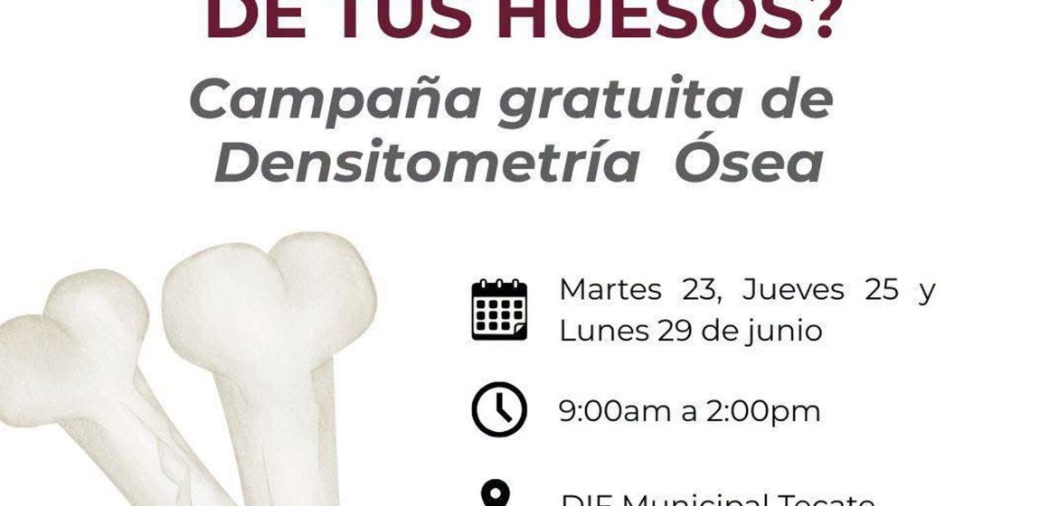 Campaña gratuita de densitometría ósea en DIF Tecate