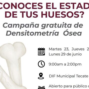 1 Campaña gratuita de densitometría ósea en DIF Tecate